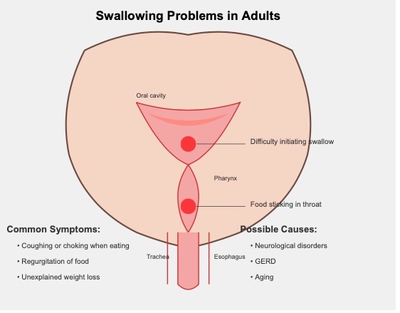 managing dysphagia in adults